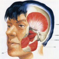 ◆歯磨きしていても虫歯になる