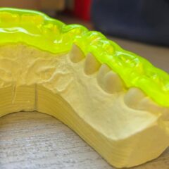 ◆正しい姿勢維持と歯の関係