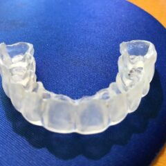 ◆噛み合せは超重要ですが、全てではありません！